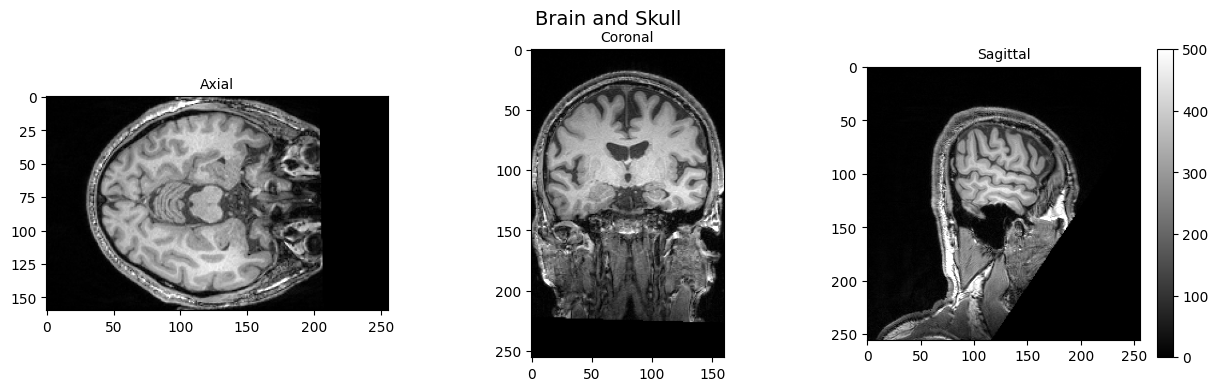 ../_images/305942f64448f1d50ed1b11ad0858227a4dcc464644c51951bc6638a85cdd96f.png